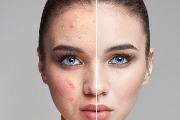 Skin Disorder Skin Disorder